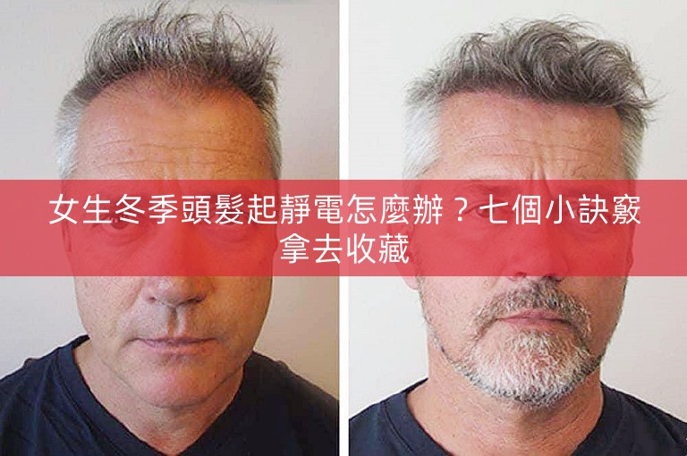 女生冬季頭髮起靜電怎麼辦?七個小訣竅拿去收藏 女生冬季頭髮起靜電怎麼辦?七個小訣竅拿去收藏