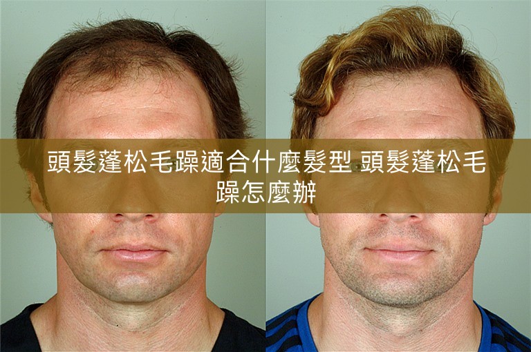 頭髮蓬松毛躁適合什麼髮型 頭髮蓬松毛躁怎麼辦 頭髮蓬松毛躁適合什麼髮型 頭髮蓬松毛躁怎麼辦