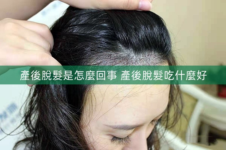 產後脫髮是怎麼回事 產後脫髮吃什麼好