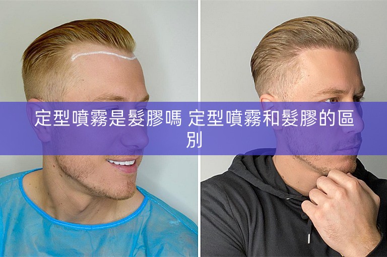 定型噴霧是髮膠嗎 定型噴霧和髮膠的區別