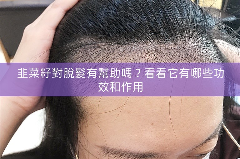 韭菜籽對脫髮有幫助嗎？看看它有哪些功效和作用