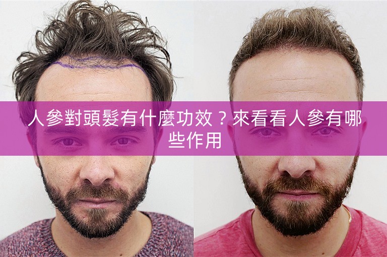 人參對頭髮有什麼功效？來看看人參有哪些作用