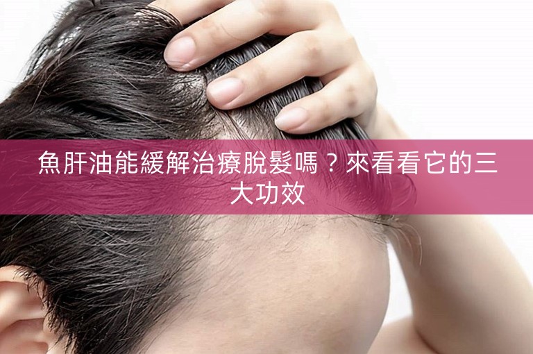 魚肝油能緩解治療脫髮嗎？來看看它的三大功效