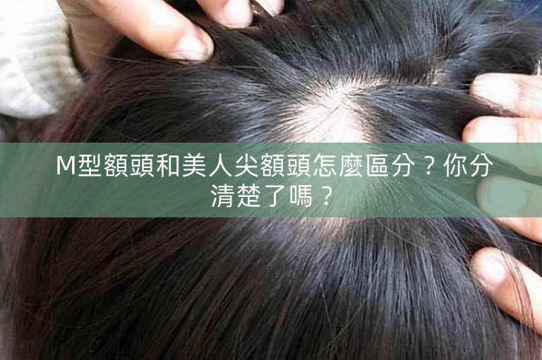 M型額頭和美人尖額頭怎麼區分?你分清楚了嗎? M型額頭和美人尖額頭怎麼區分?你分清楚了嗎?
