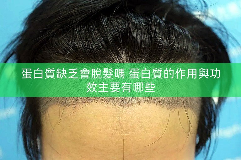 蛋白質缺乏會脫髮嗎 蛋白質的作用與功效主要有哪些 蛋白質缺乏會脫髮嗎 蛋白質的作用與功效主要有哪些