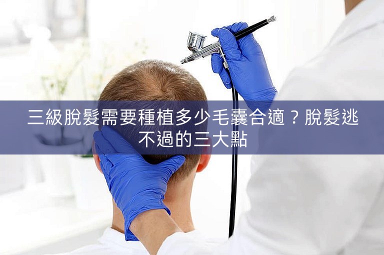 三級脫髮需要種植多少毛囊合適？脫髮逃不過的三大點