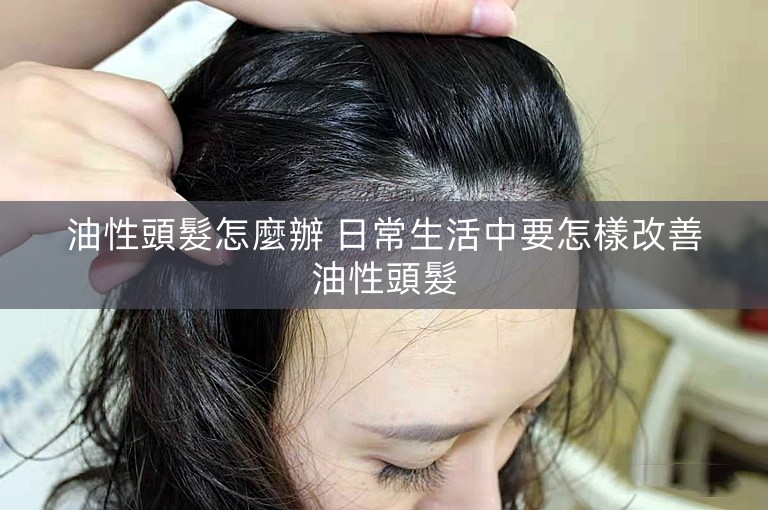 油性頭髮怎麼辦 日常生活中要怎樣改善油性頭髮