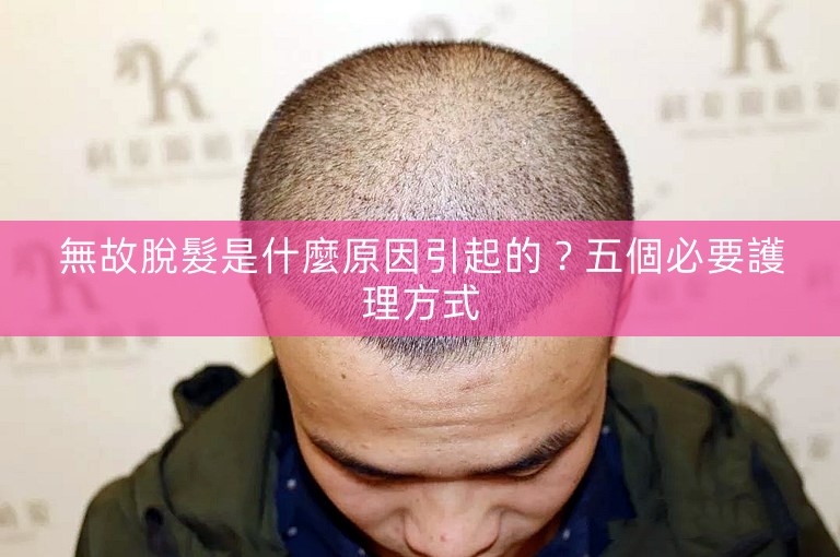 無故脫髮是什麼原因引起的？五個必要護理方式