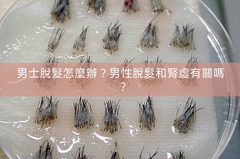 男士脫髮怎麼辦？男性脫髮和腎虛有關嗎？