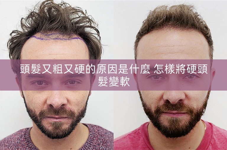 頭髮又粗又硬的原因是什麼 怎樣將硬頭髮變軟 頭髮又粗又硬的原因是什麼 怎樣將硬頭髮變軟