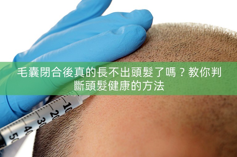 毛囊閉合後真的長不出頭髮了嗎?教你判斷頭髮健康的方法 毛囊閉合後真的長不出頭髮了嗎?教你判斷頭髮健康的方法
