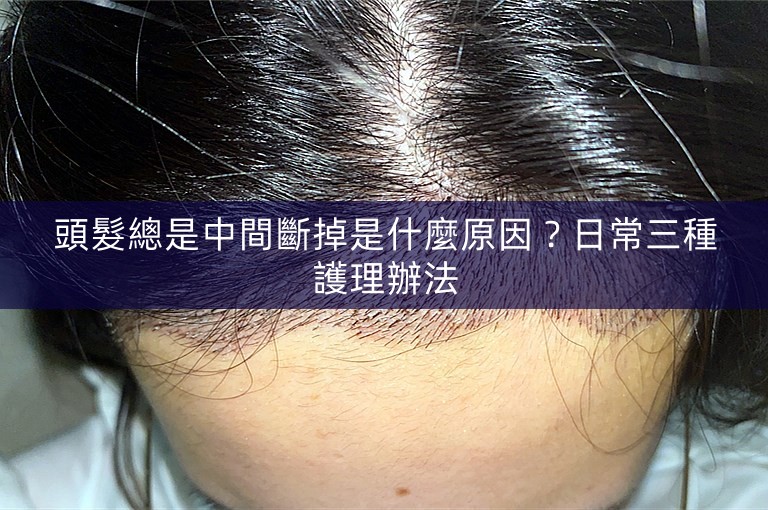 頭髮總是中間斷掉是什麼原因？日常三種護理辦法