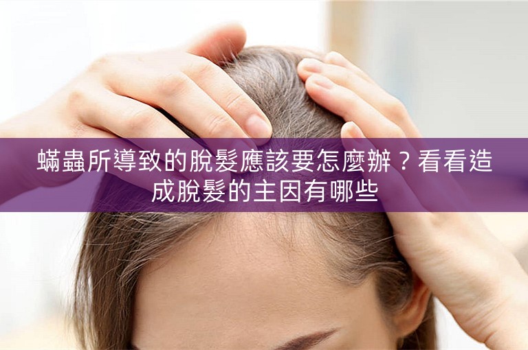 蟎蟲所導致的脫髮應該要怎麼辦？看看造成脫髮的主因有哪些