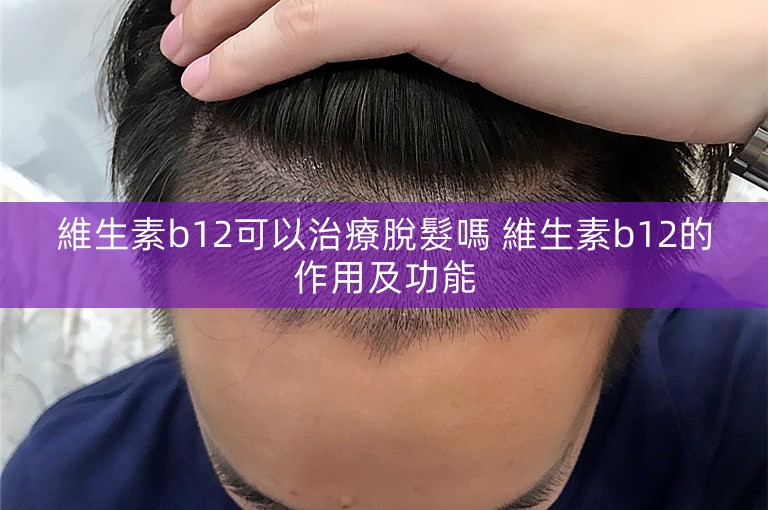 維生素b12可以治療脫髮嗎 維生素b12的作用及功能