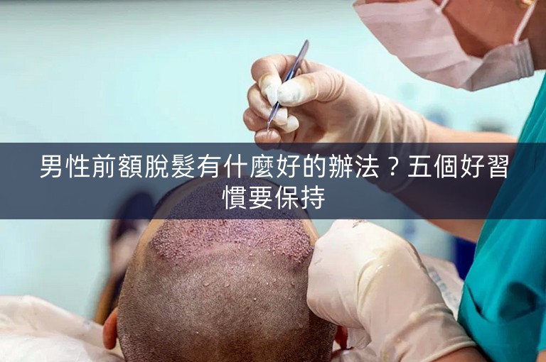 男性前額脫髮有什麼好的辦法？五個好習慣要保持