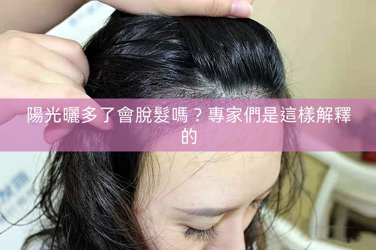 陽光曬多了會脫髮嗎？專家們是這樣解釋的