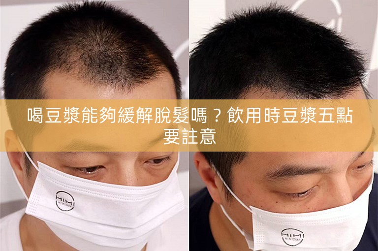 喝豆漿能夠緩解脫髮嗎？飲用時豆漿五點要註意