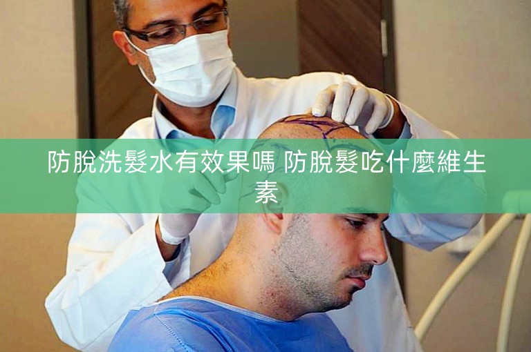 防脫洗髮水有效果嗎 防脫髮吃什麼維生素