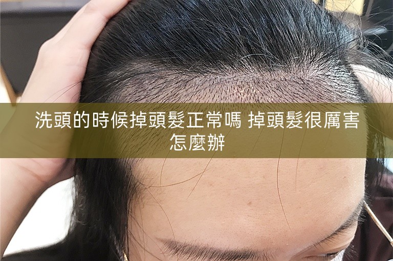 洗頭的時候掉頭髮正常嗎 掉頭髮很厲害怎麼辦 洗頭的時候掉頭髮正常嗎 掉頭髮很厲害怎麼辦