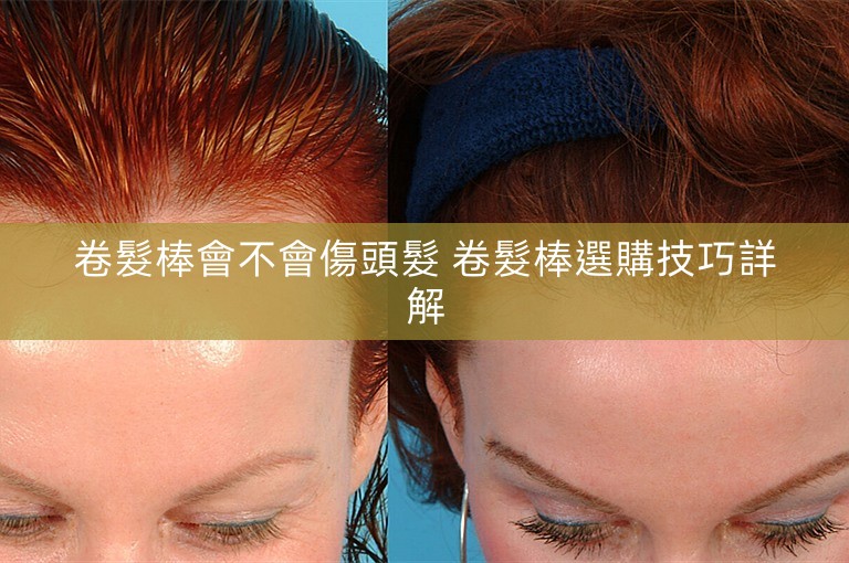 卷髮棒會不會傷頭髮 卷髮棒選購技巧詳解 卷髮棒會不會傷頭髮 卷髮棒選購技巧詳解