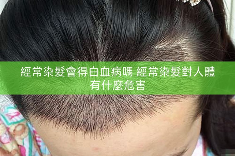 經常染髮會得白血病嗎 經常染髮對人體有什麼危害 經常染髮會得白血病嗎 經常染髮對人體有什麼危害