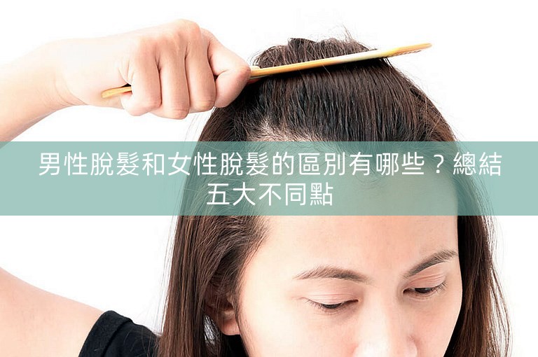 男性脫髮和女性脫髮的區別有哪些？總結五大不同點