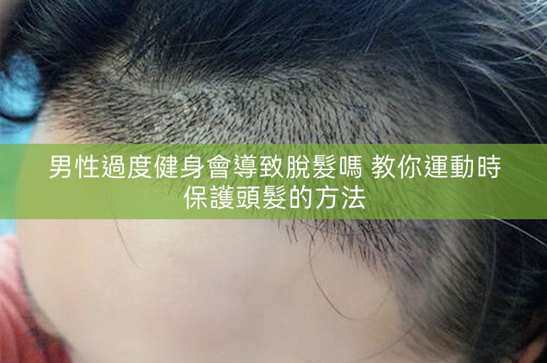 男性過度健身會導致脫髮嗎 教你運動時保護頭髮的方法