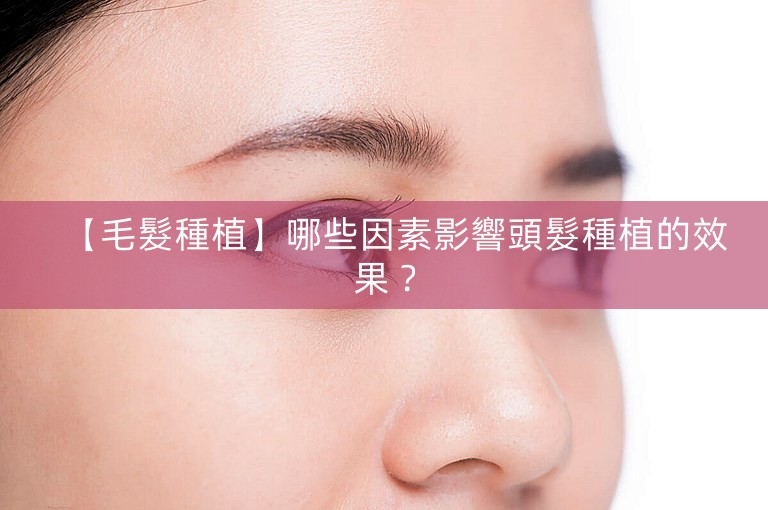【毛髮種植】哪些因素影響頭髮種植的效果? 【毛髮種植】哪些因素影響頭髮種植的效果?