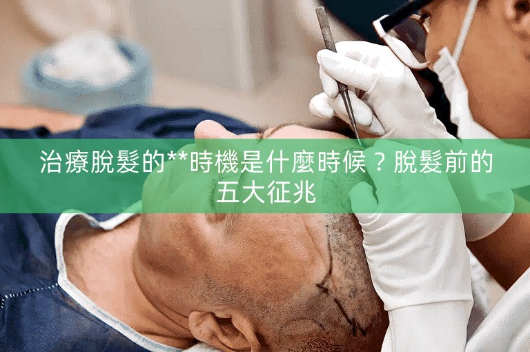 治療脫髮的**時機是什麼時候？脫髮前的五大征兆
