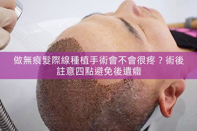 做無痕髮際線種植手術會不會很疼？術後註意四點避免後遺癥