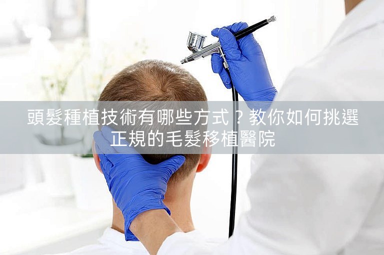頭髮種植技術有哪些方式？教你如何挑選正規的毛髮移植醫院