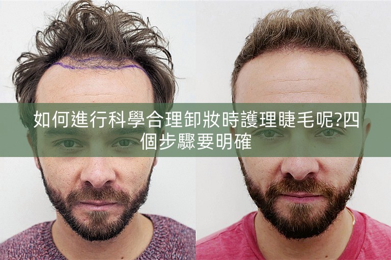 如何進行科學合理卸妝時護理睫毛呢?四個步驟要明確 如何進行科學合理卸妝時護理睫毛呢?四個步驟要明確