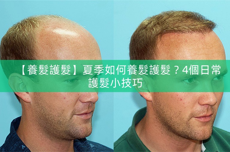 【養髮護髮】夏季如何養髮護髮？4個日常護髮小技巧