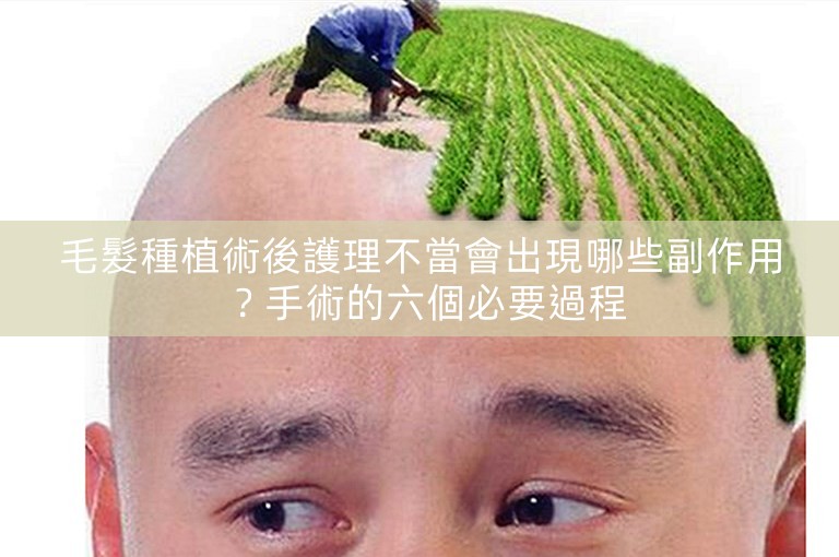 毛髮種植術後護理不當會出現哪些副作用？手術的六個必要過程