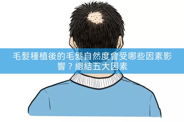 毛髮種植後的毛髮自然度會受哪些因素影響?總結五大因素 毛髮種植後的毛髮自然度會受哪些因素影響?總結五大因素