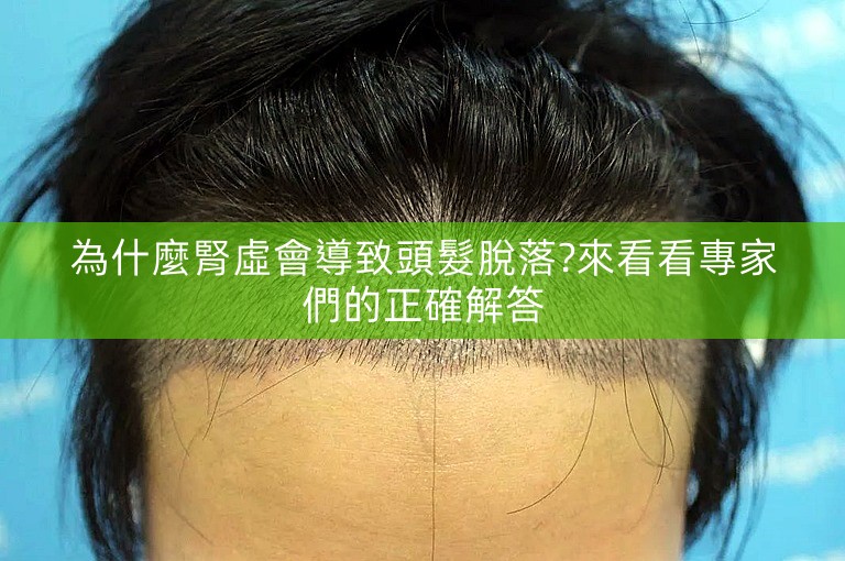 為什麼腎虛會導致頭髮脫落?來看看專家們的正確解答