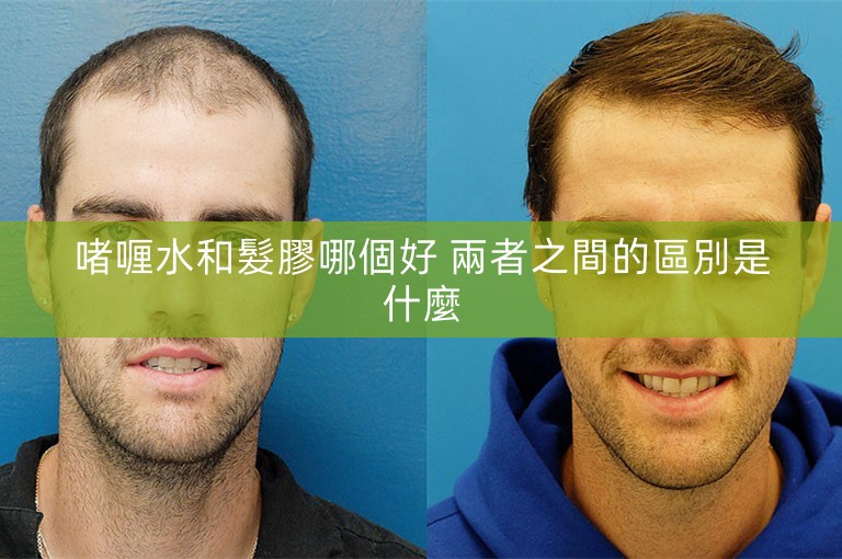 啫喱水和髮膠哪個好 兩者之間的區別是什麼 啫喱水和髮膠哪個好 兩者之間的區別是什麼