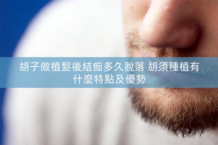 胡子做植髮後結痂多久脫落 胡須種植有什麼特點及優勢