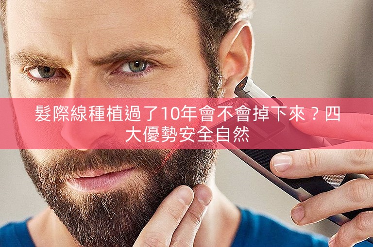 髮際線種植過了10年會不會掉下來？四大優勢安全自然