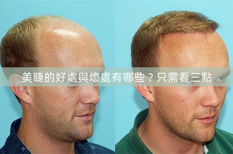 美睫的好處與壞處有哪些?只需看三點 美睫的好處與壞處有哪些?只需看三點