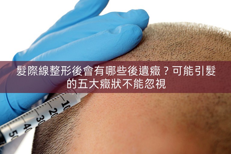 髮際線整形後會有哪些後遺癥？可能引髮的五大癥狀不能忽視