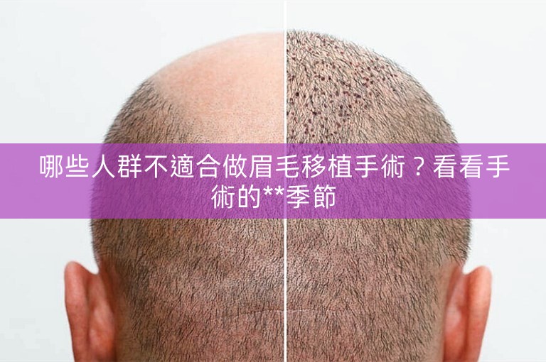 哪些人群不適合做眉毛移植手術？看看手術的**季節