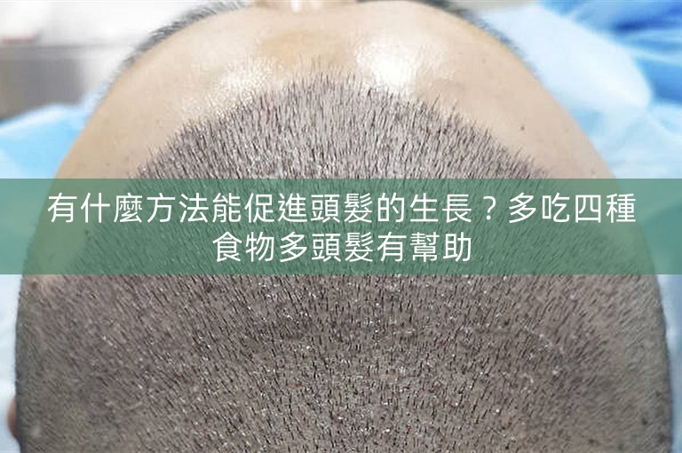 有什麼方法能促進頭髮的生長？多吃四種食物多頭髮有幫助