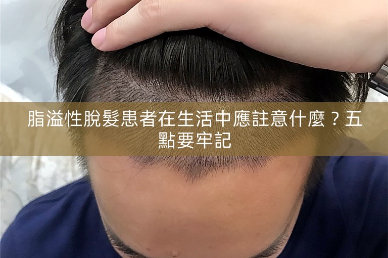 脂溢性脫髮患者在生活中應註意什麼？五點要牢記