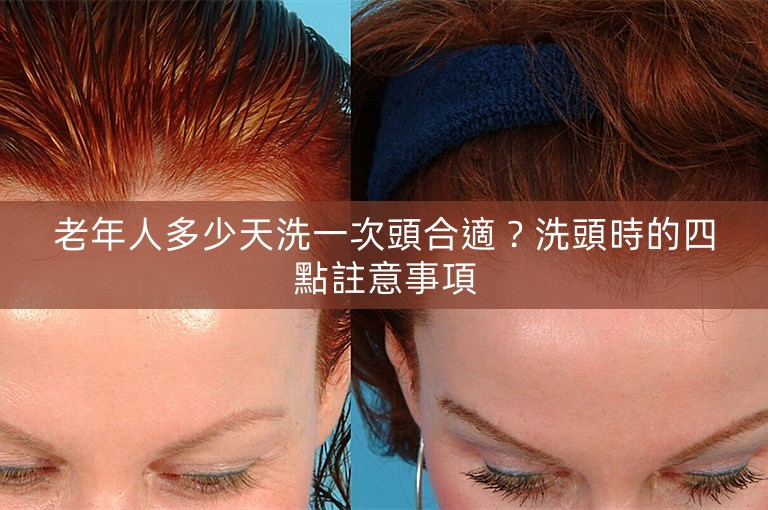 老年人多少天洗一次頭合適？洗頭時的四點註意事項
