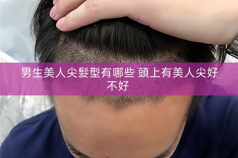 男生美人尖髮型有哪些 頭上有美人尖好不好 男生美人尖髮型有哪些 頭上有美人尖好不好