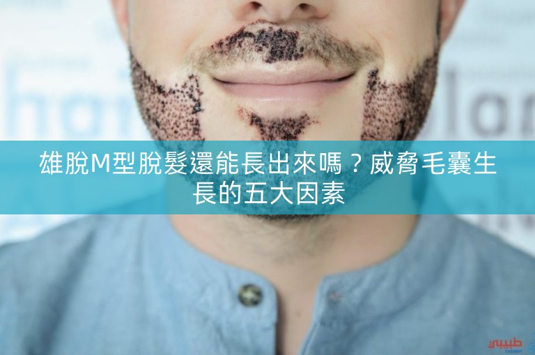 雄脫M型脫髮還能長出來嗎？威脅毛囊生長的五大因素