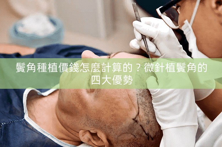 鬢角種植價錢怎麼計算的？微針植鬢角的四大優勢