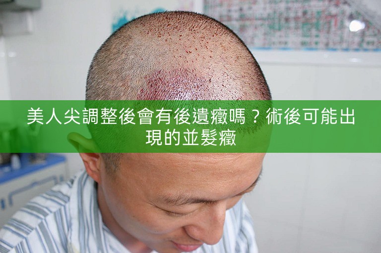 美人尖調整後會有後遺癥嗎？術後可能出現的並髮癥