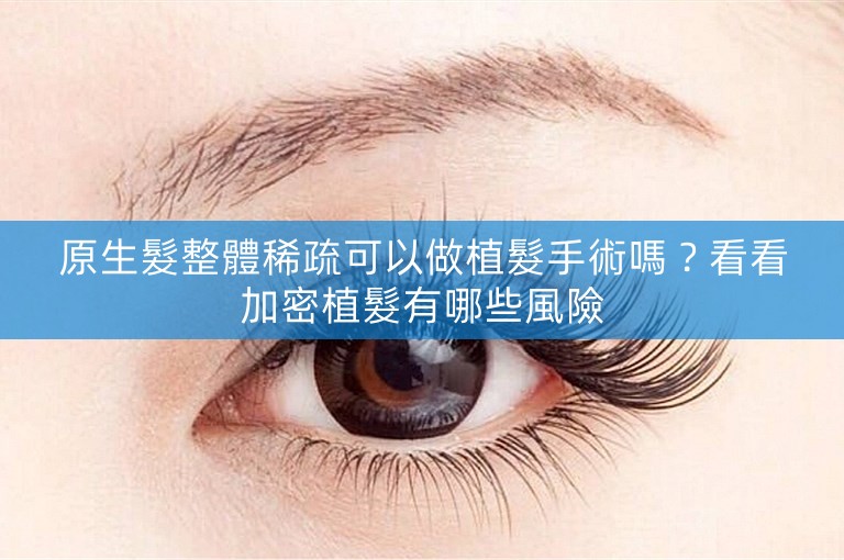 原生髮整體稀疏可以做植髮手術嗎？看看加密植髮有哪些風險